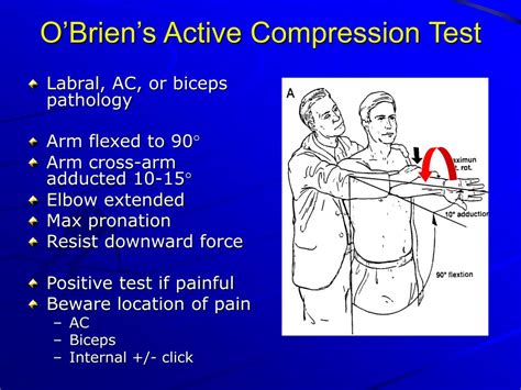 ac compression test|active compression test shoulder.